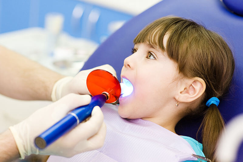 فیشور سیلانت دندان کودکان یا شیار پوش دندان کودکان - دکتر فائزه فتوحی