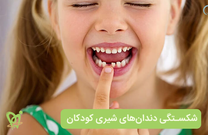 بررسی دلایل شکستگی دندان های شیری کودکان - دکتر فائزه فتوحی