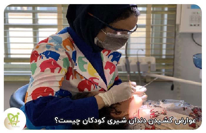 عوارض کشیدن دندان شیری کودکان - دکتر فائزه فتوحی